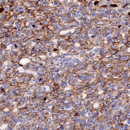 CD19 Recombinant Rabbit mAb (SDT-164-33)