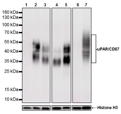 uPAR/CD87 Recombinant Rabbit mAb (S-3960-82)