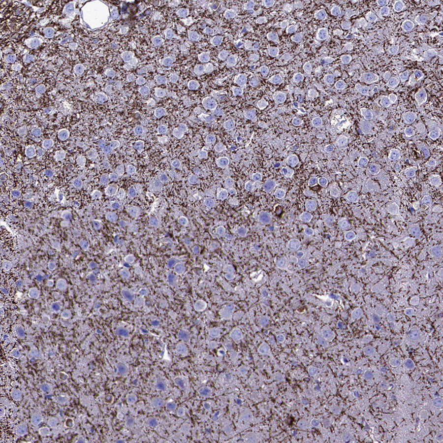 SIRT2 Mouse mAb