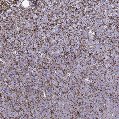 SIRT2 Mouse mAb