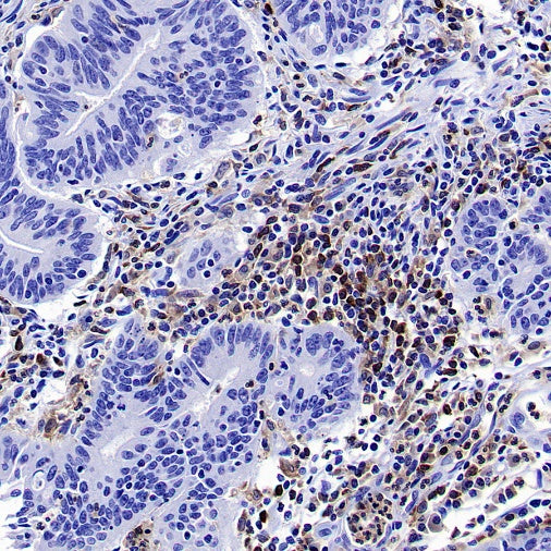 BTK Recombinant Rabbit mAb (SDT-2105-37)