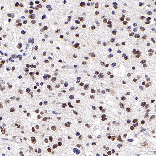 SUMO-1 Recombinant Rabbit mAb (S-625-111)