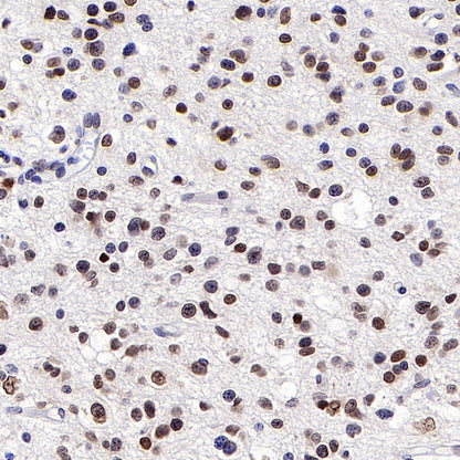 SUMO-1 Recombinant Rabbit mAb (S-625-111)