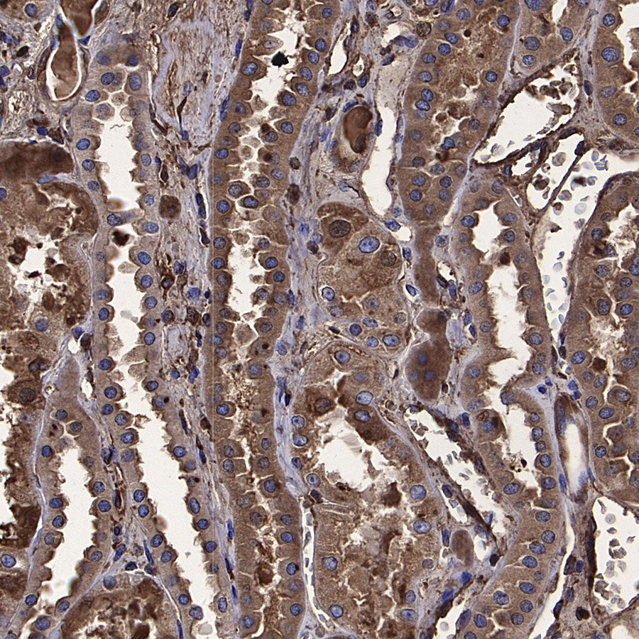 Choline Kinase α/CHKA Recombinant Rabbit mAb (S-4422-31)