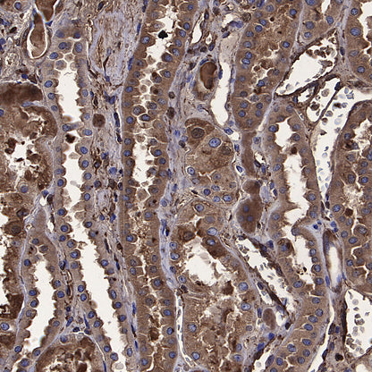 Choline Kinase α/CHKA Recombinant Rabbit mAb (S-4422-31)