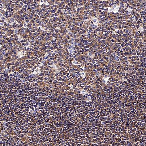 NF-κB p105/p50 Rabbit polyclonal antibody