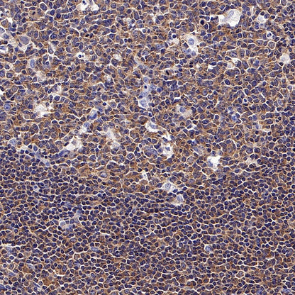 NF-κB p105/p50 Rabbit polyclonal antibody