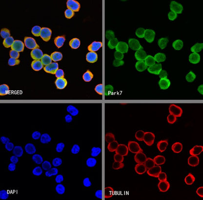 Park7/DJ-1 Recombinant Rabbit mAb (S-980-144)
