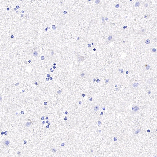 T-bet/TBX21 Recombinant Rabbit mAb (S-583-54)