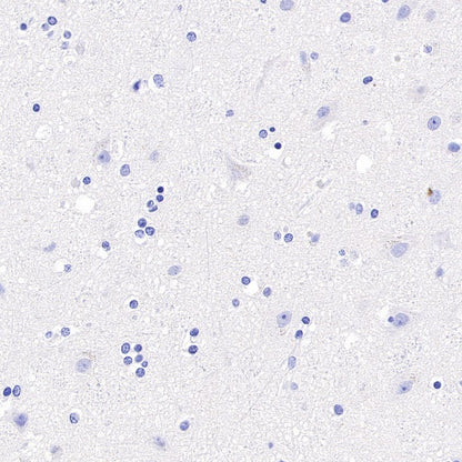 T-bet/TBX21 Recombinant Rabbit mAb (S-583-54)