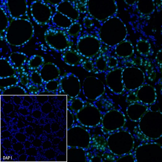 PAX8 Recombinant Rabbit mAb (SDT-R509)