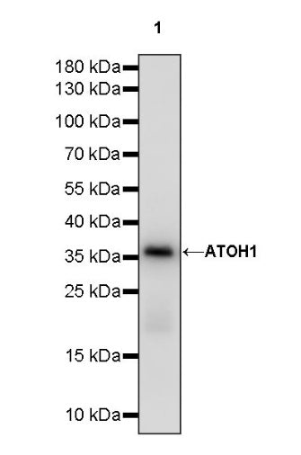 ATOH1 Recombinant Rabbit mAb (S-1301-11)