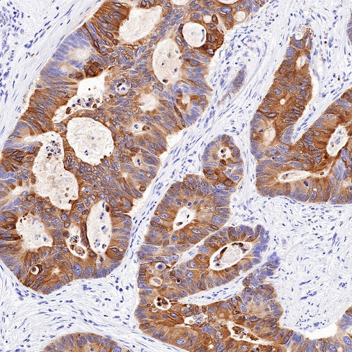 COX2 Recombinant Rabbit mAb (SDT-380-259)