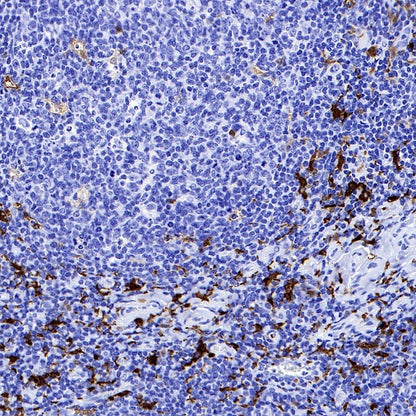 S-RMab® Factor XIIIa Recombinant Rabbit mAb (SDT-R278)