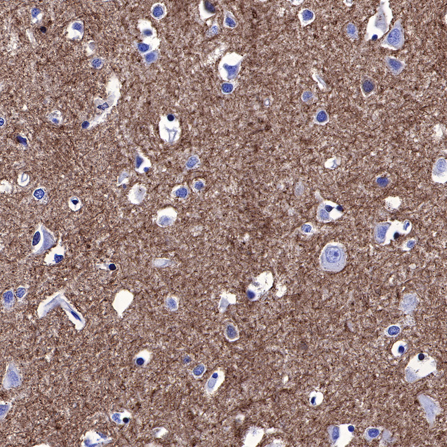 Stathmin 1 Recombinant Rabbit mAb (SDT-383-4)