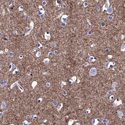 Stathmin 1 Recombinant Rabbit mAb (SDT-383-4)