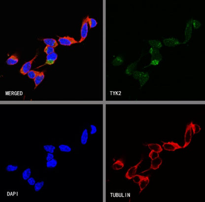 TYK2 Recombinant Rabbit mAb (S-2740-165)