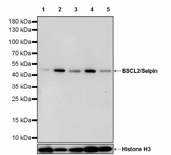 BSCL2/Seipin Recombinant Rabbit mAb (S-1669-135)