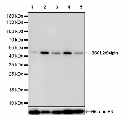 BSCL2/Seipin Recombinant Rabbit mAb (S-1669-135)