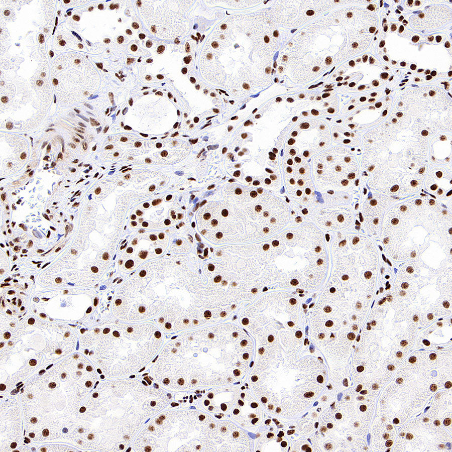 PABPN1 Rabbit Polyclonal Antibody