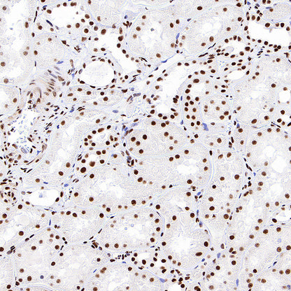 PABPN1 Rabbit Polyclonal Antibody