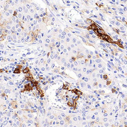 CD86 Recombinant Rabbit mAb (S-6175)