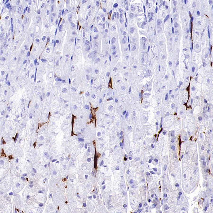 AOAH Recombinant Rabbit mAb (S-3713-10)