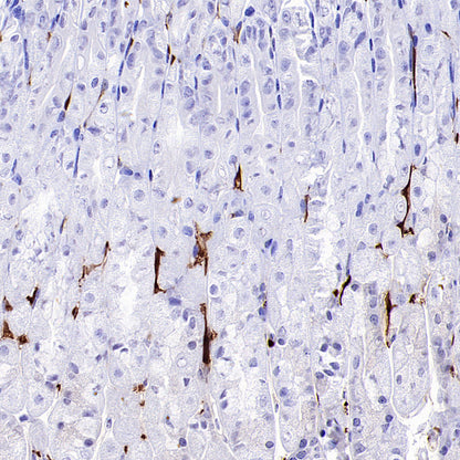 AOAH Recombinant Rabbit mAb (S-3713-10)