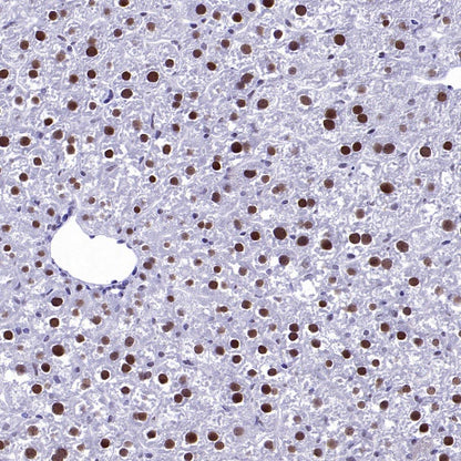 CDK9 Recombinant Rabbit mAb (S-2661-10)