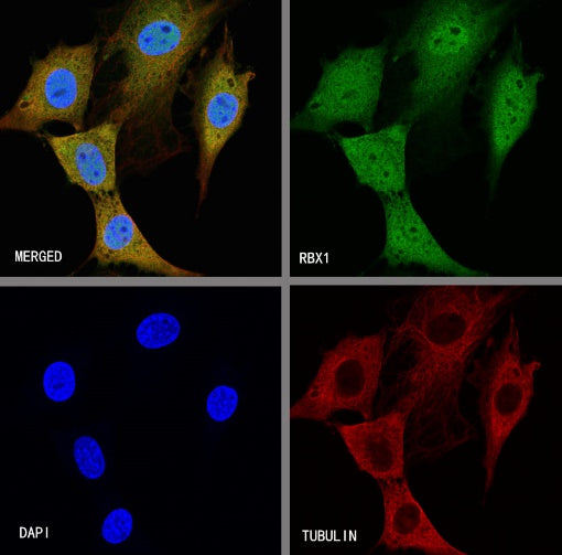 RBX1 Recombinant Rabbit mAb (S-R355)