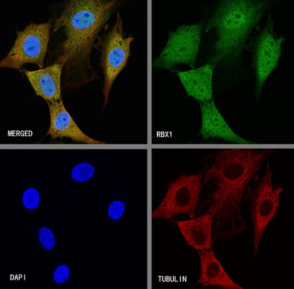 RBX1 Recombinant Rabbit mAb (S-R355)