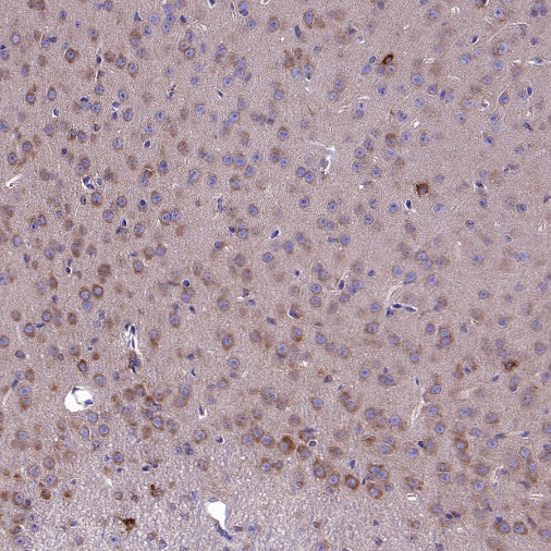 SQLE Recombinant Rabbit mAb (S-2358-207)
