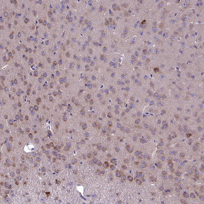 SQLE Recombinant Rabbit mAb (S-2358-207)