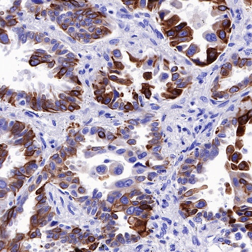 MUC4 Recombinant Rabbit mAb (SDT-R228)
