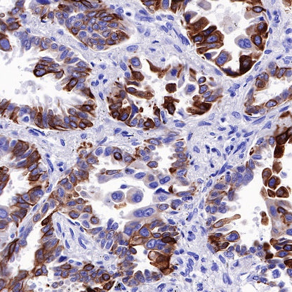 MUC4 Recombinant Rabbit mAb (SDT-R228)