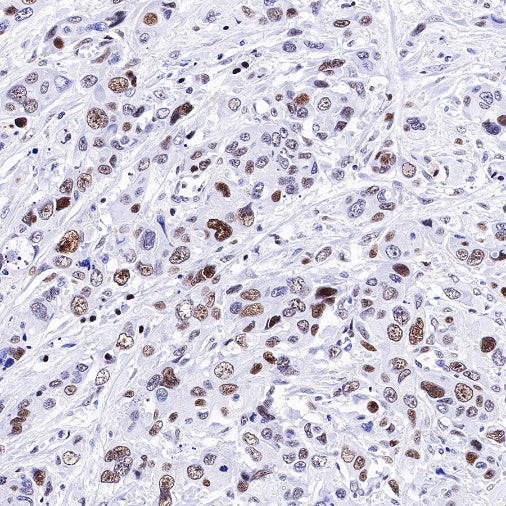 Nog1 Recombinant Rabbit mAb (S-R330)