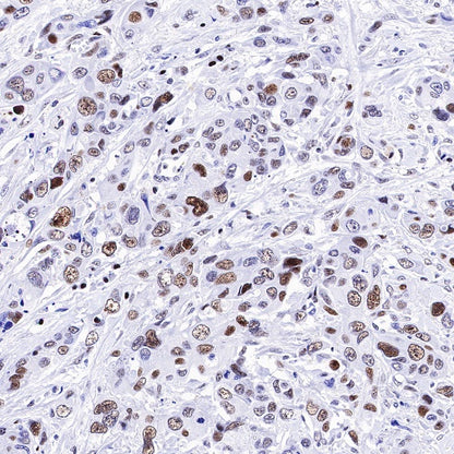 Nog1 Recombinant Rabbit mAb (S-R330)