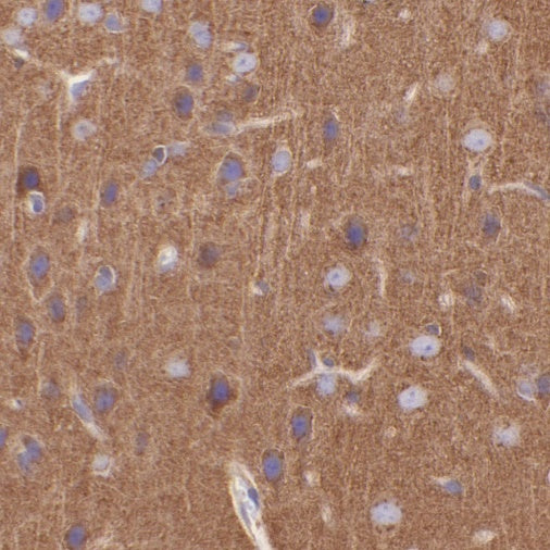 Clathrin heavy chain Recombinant Rabbit mAb (S-1690-25)