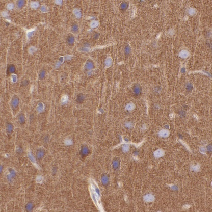 Clathrin heavy chain Recombinant Rabbit mAb (S-1690-25)