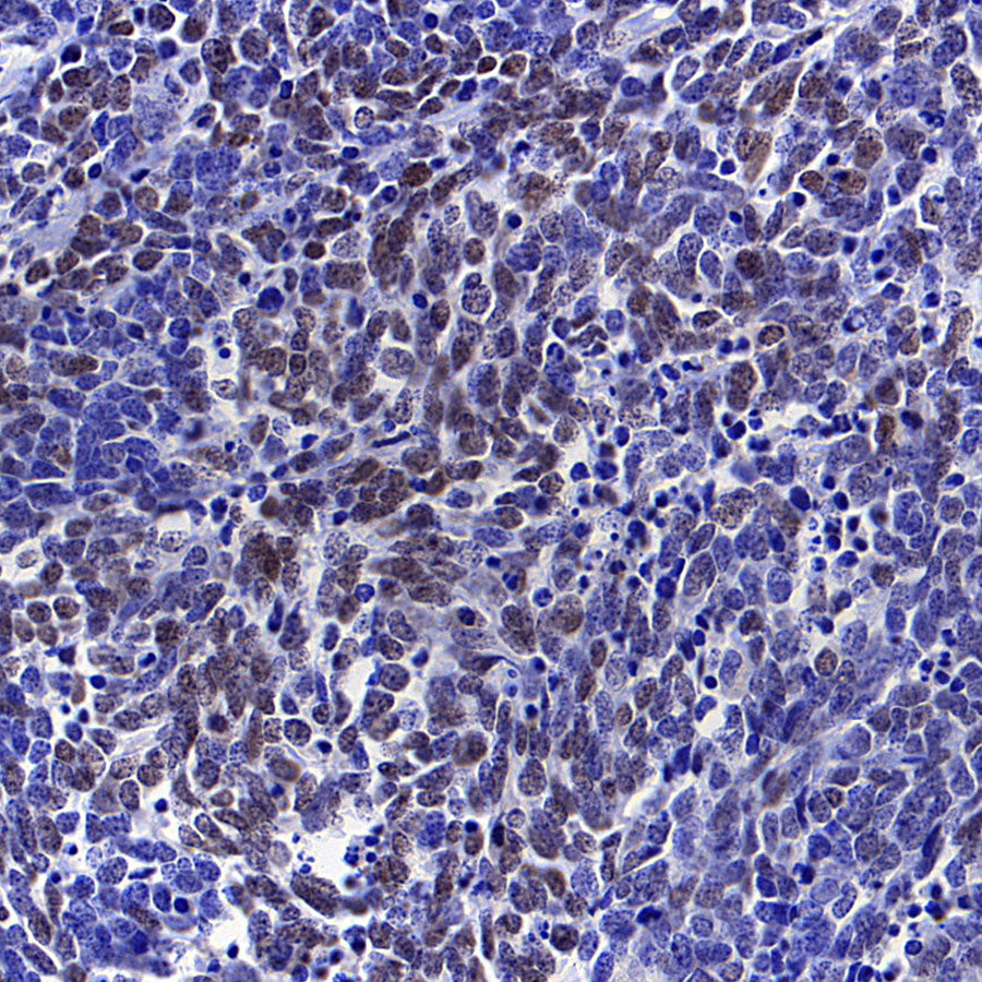 NeuroD1 Recombinant Rabbit mAb (SDT-3843-59)