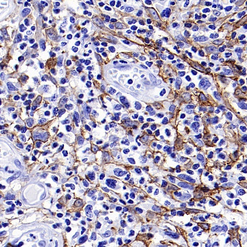 Podoplanin (D2-40) Recombinant Rabbit mAb (SDT-1178-8)