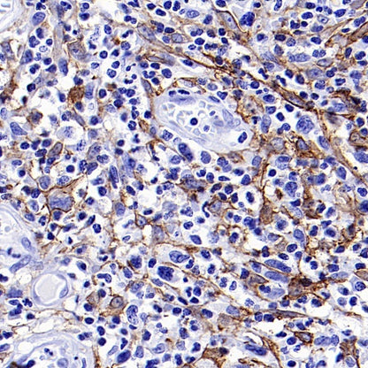 Podoplanin (D2-40) Recombinant Rabbit mAb (SDT-1178-8)