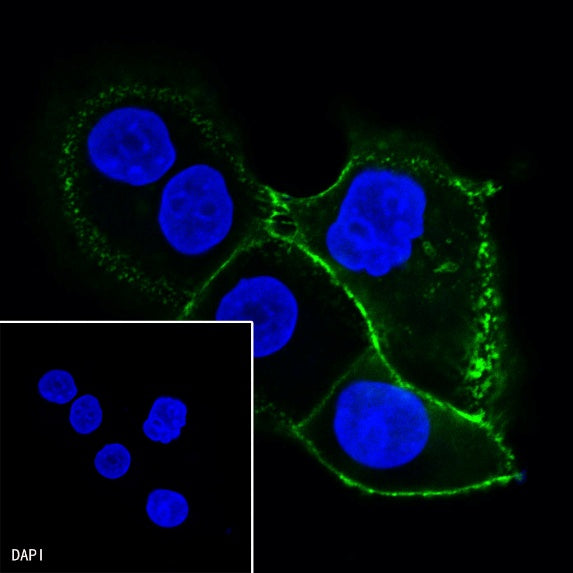 CD44 Recombinant Rabbit mAb (SDT-R107)