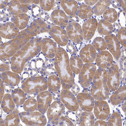 PRDM1/Blimp1 Recombinant Rabbit mAb (S-1972-3)
