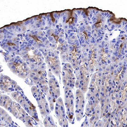 RAB27A Mouse mAb (S-M0050)
