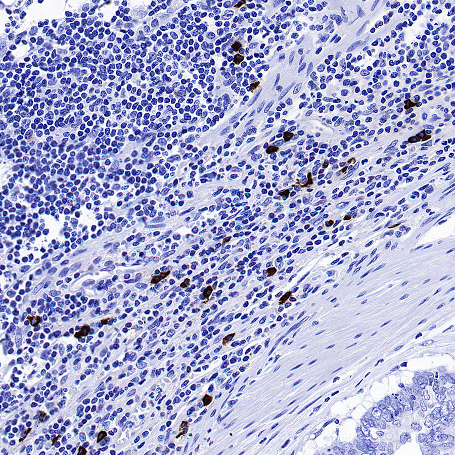 HEG1 Recombinant Rabbit mAb (S-4419-64)