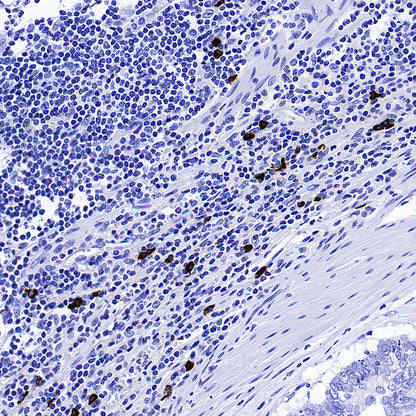 HEG1 Recombinant Rabbit mAb (S-4419-64)