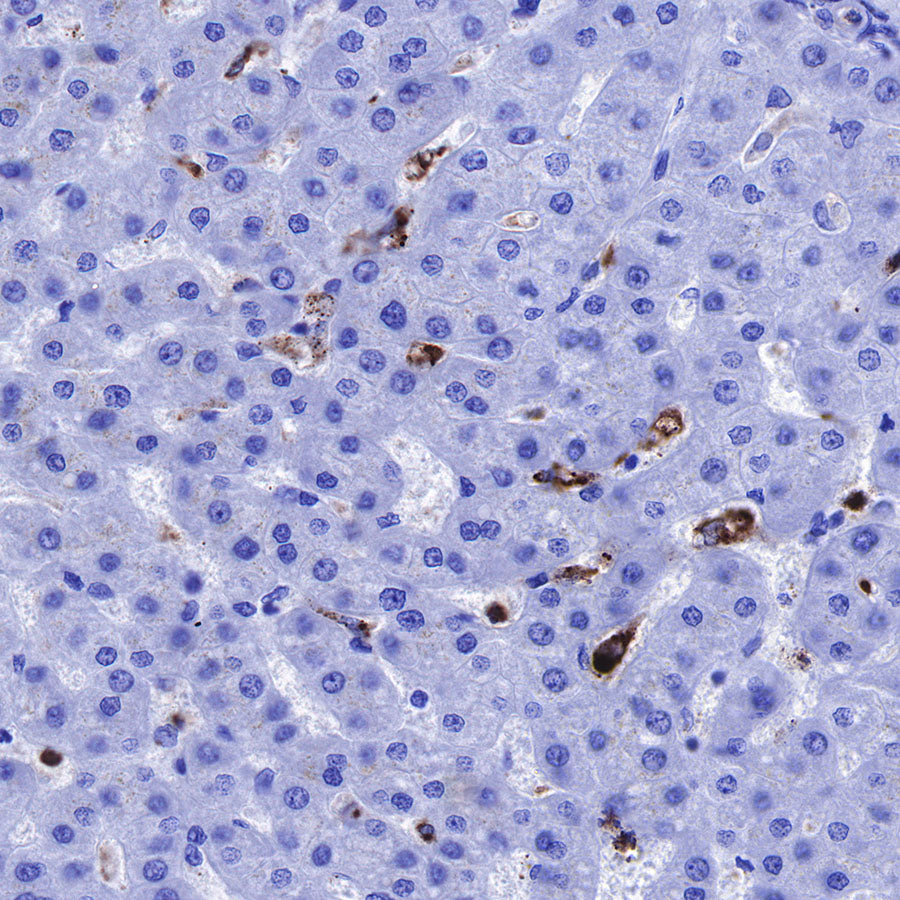 Lysozyme Recombinant Rabbit mAb (SDT-R176)