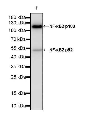 NF-κB2 p100/p52 Recombinant Rabbit mAb (S-2502-208)