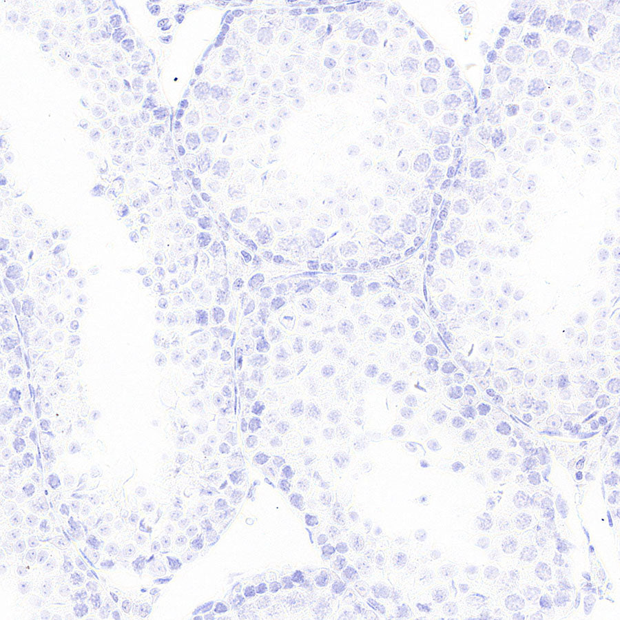 CD8α Recombinant Rabbit mAb (S-6201)
